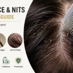 What Does Lice Look Like